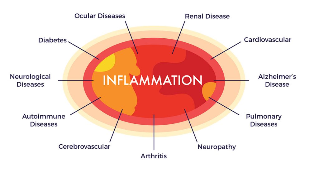 Inflammation