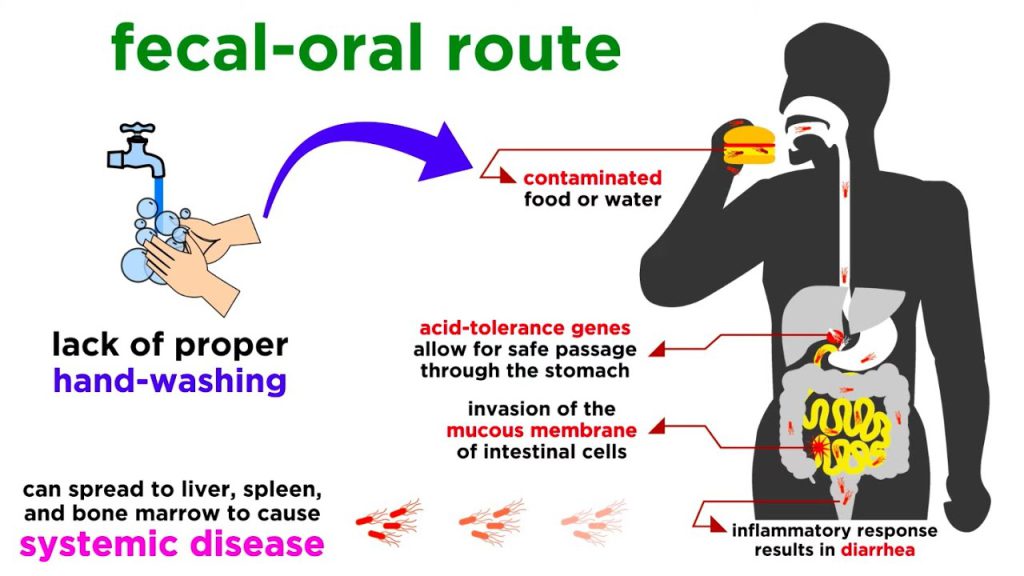 Typhoid fever